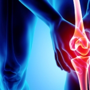 Knee painful - skeleton x-ray, 3D Illustration medical concept.