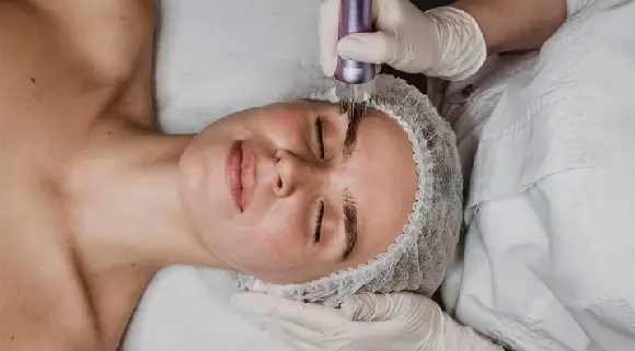 whartons-jelly-microneedling Hawaii cosmetic regenerative treatment using microneedling to apply Wharton’s Jelly to facial skin for anti-aging support.